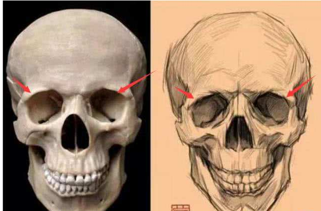 眶骨膜下膿腫發(fā)病機制